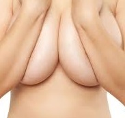 mellkisebbítés szükséges